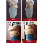 Antes e depois usando cinta modeladora feminina de alta compressão

