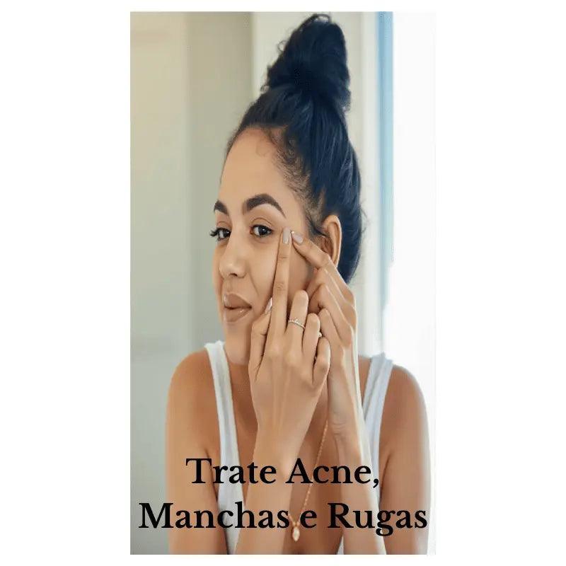 Jovem com pele radiante examina seu rosto em close, demonstrando cuidados eficazes contra acne e manchas na pele.